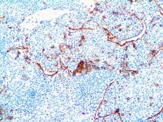 IHC of Claudin-5 on an FFPE Liver Tissue